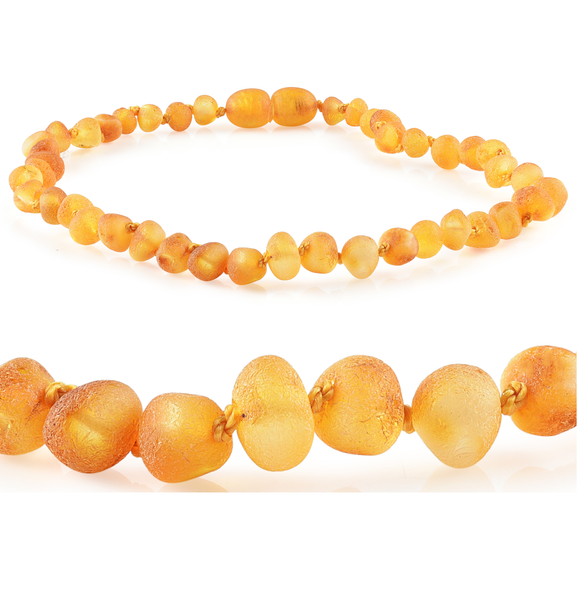 Kids | "Grow With Me" Baltic Amber Necklace Sets ~ Raw Honey